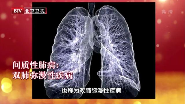 疫情期间，肺炎、慢阻肺、哮喘患者，如何分清症状保平安？